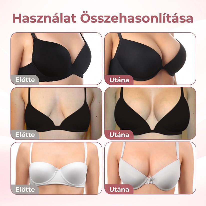 🌟HISKIN® MELLEMELŐ ÉS FESZESÍTŐ MIKROTŰS TAPASZOK